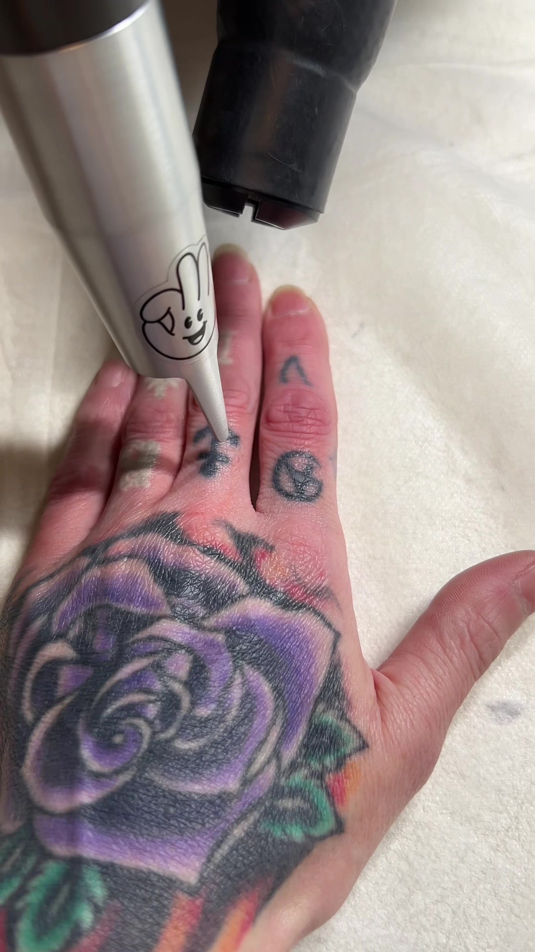 @Swift_tattoo_removal