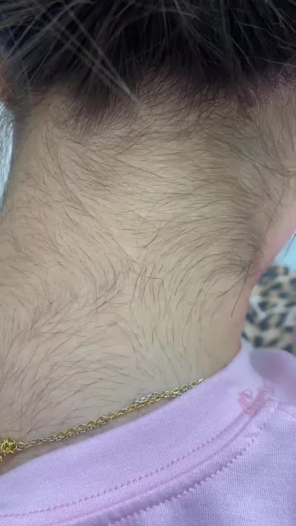 @gulu_Laser_gulu
