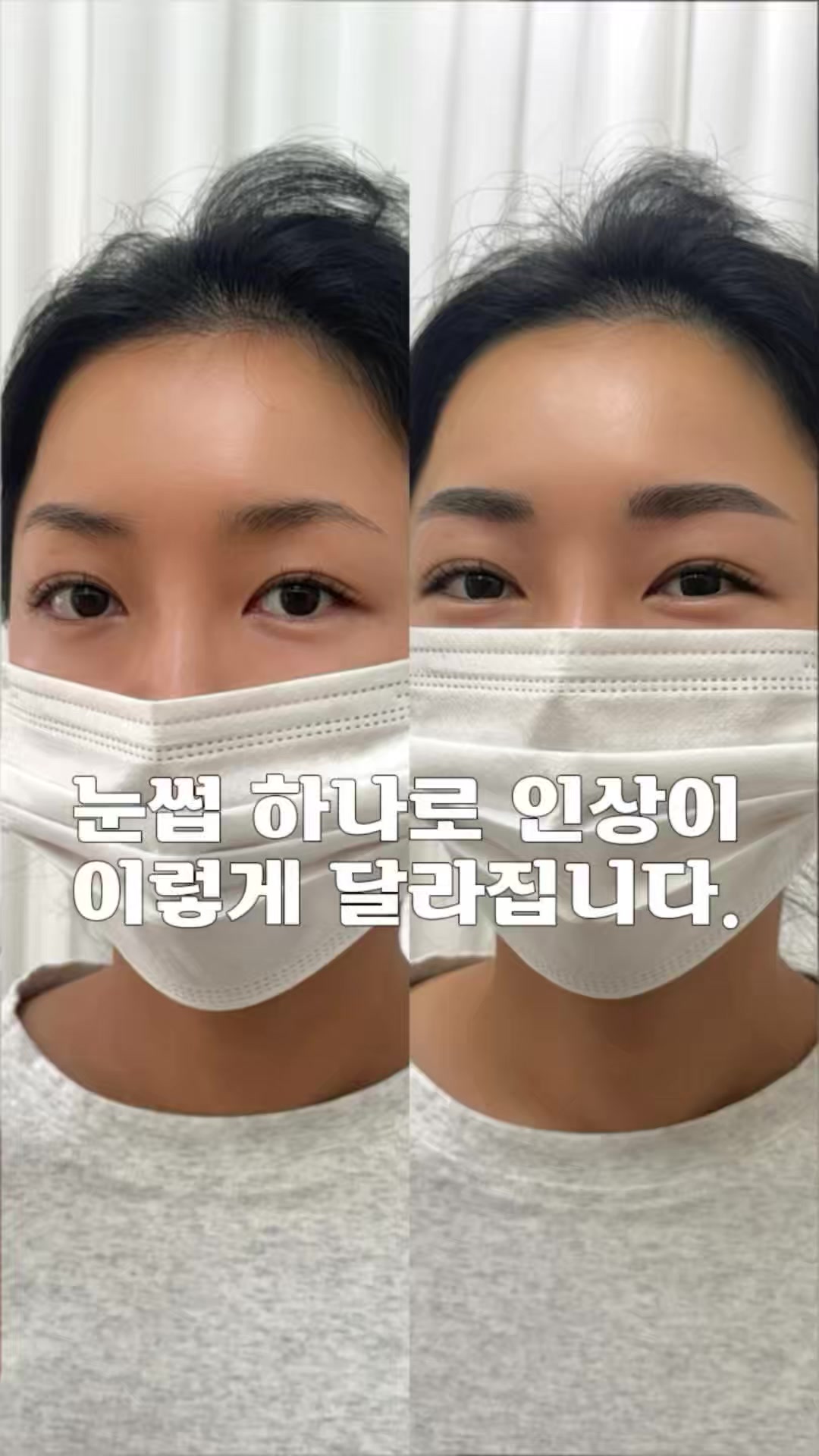 @용인눈썹문신|용인입술문신 브로우뉴진
