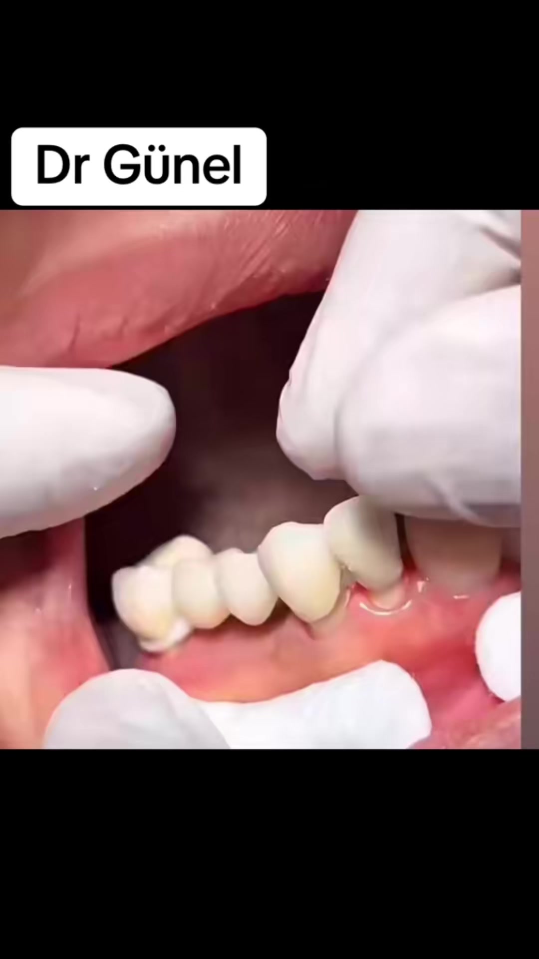 @Dentist_Günel