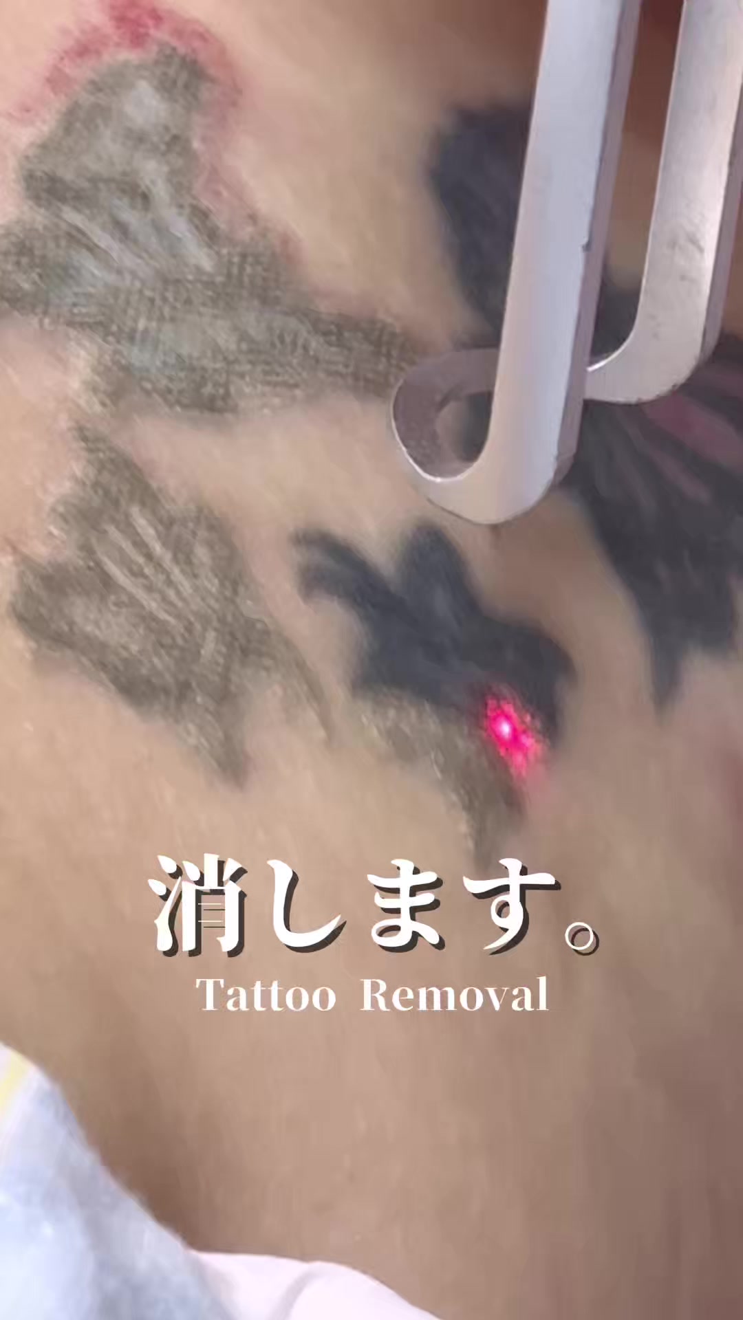 @ルラ美容クリニック大阪本院