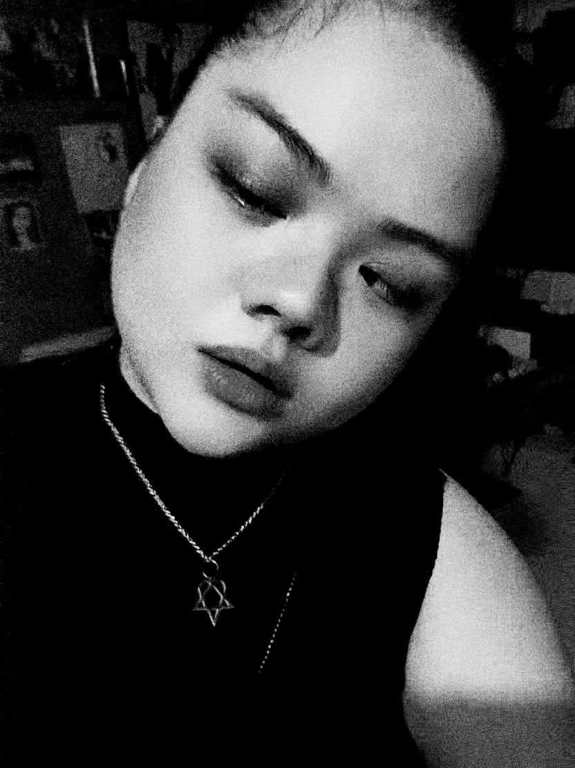 @Zamantha | The Strabismuse
