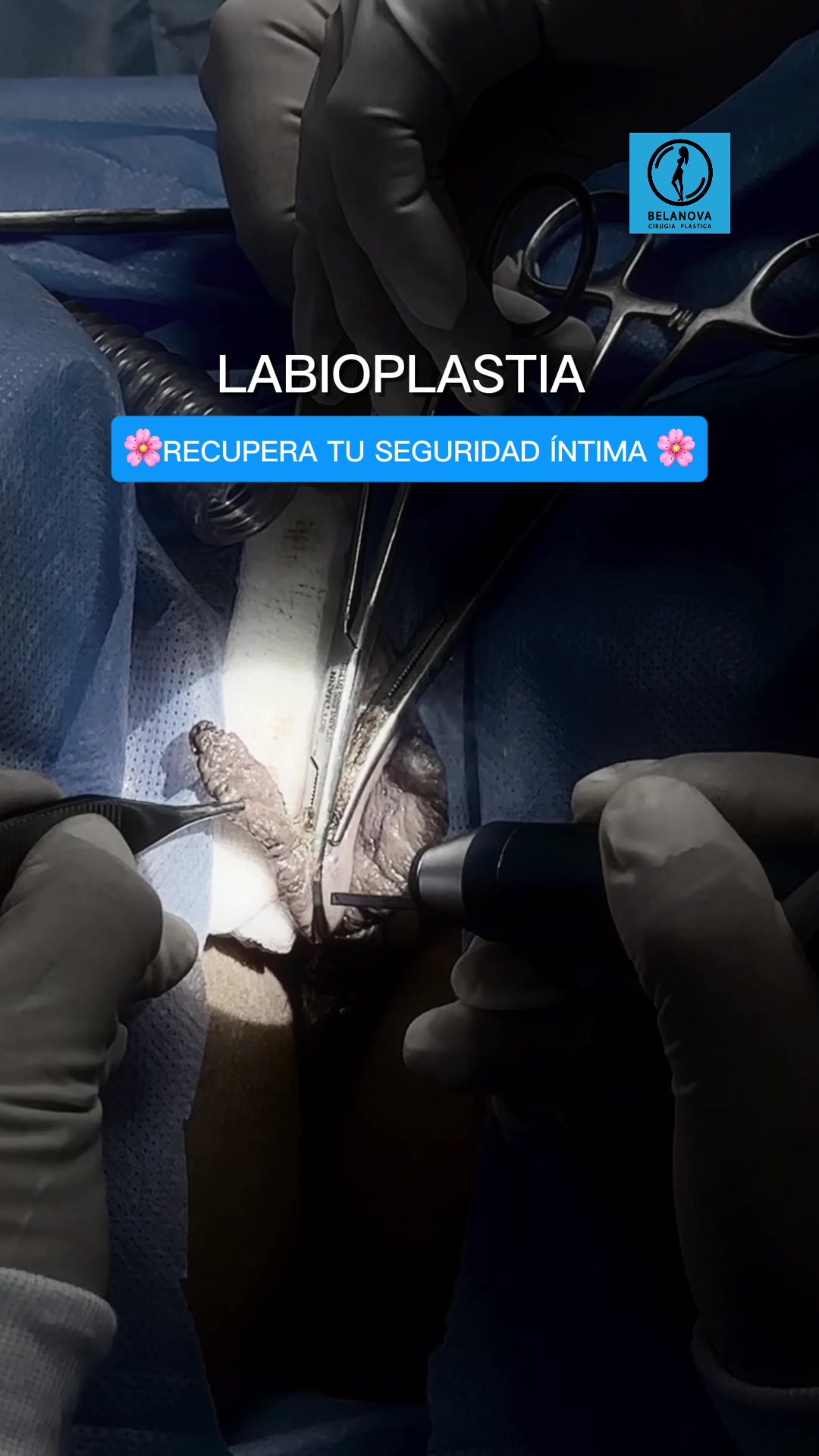 @Belanovacirugiaplastica
