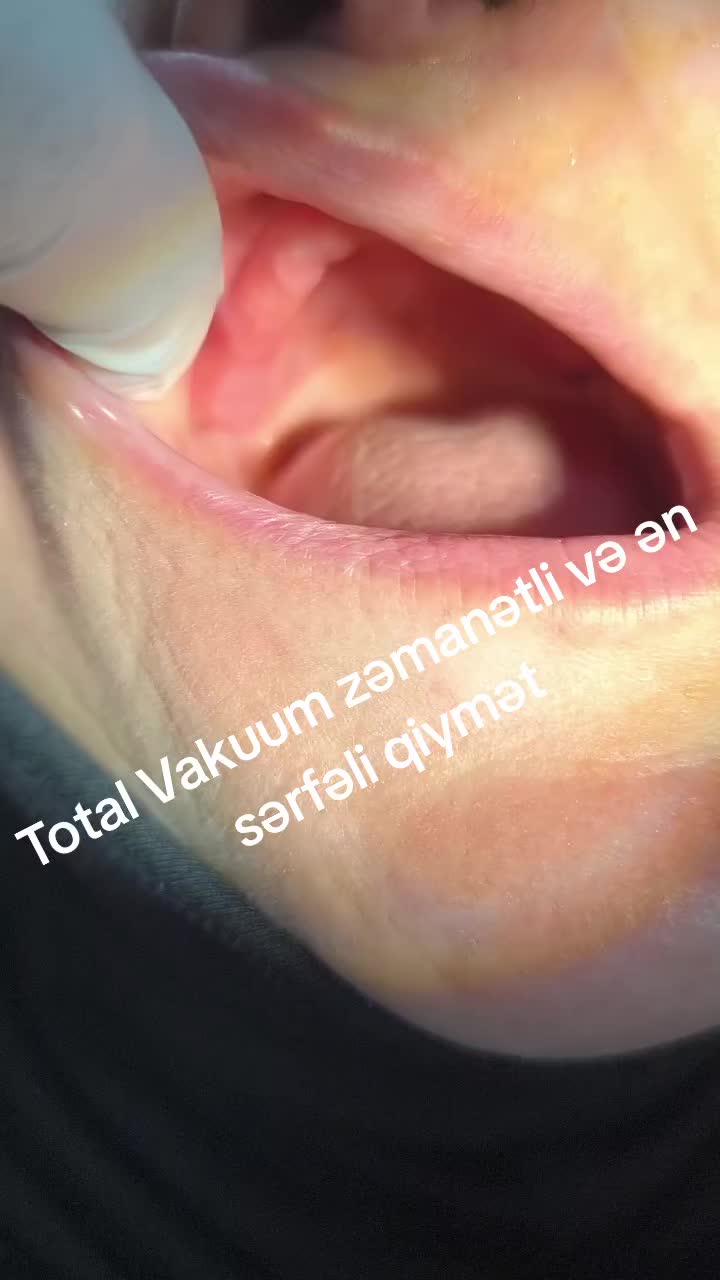 @implant.32