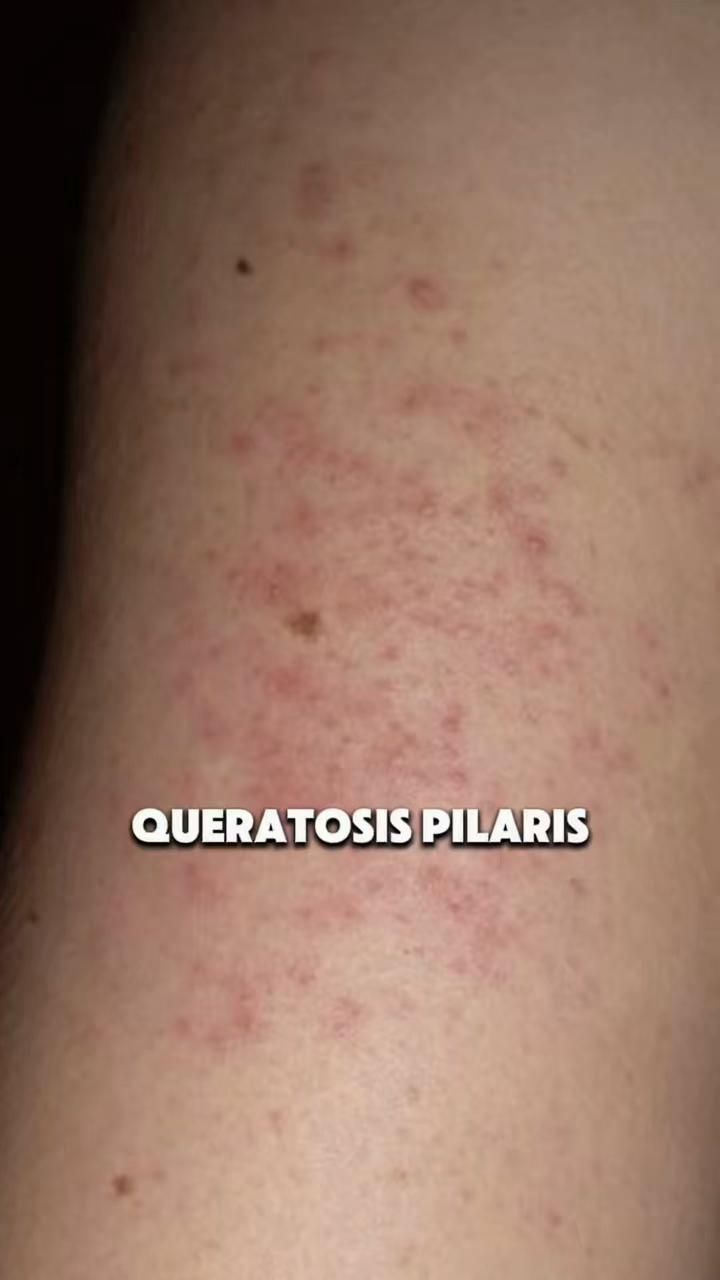 @Dermatóloga Cindy Burbano