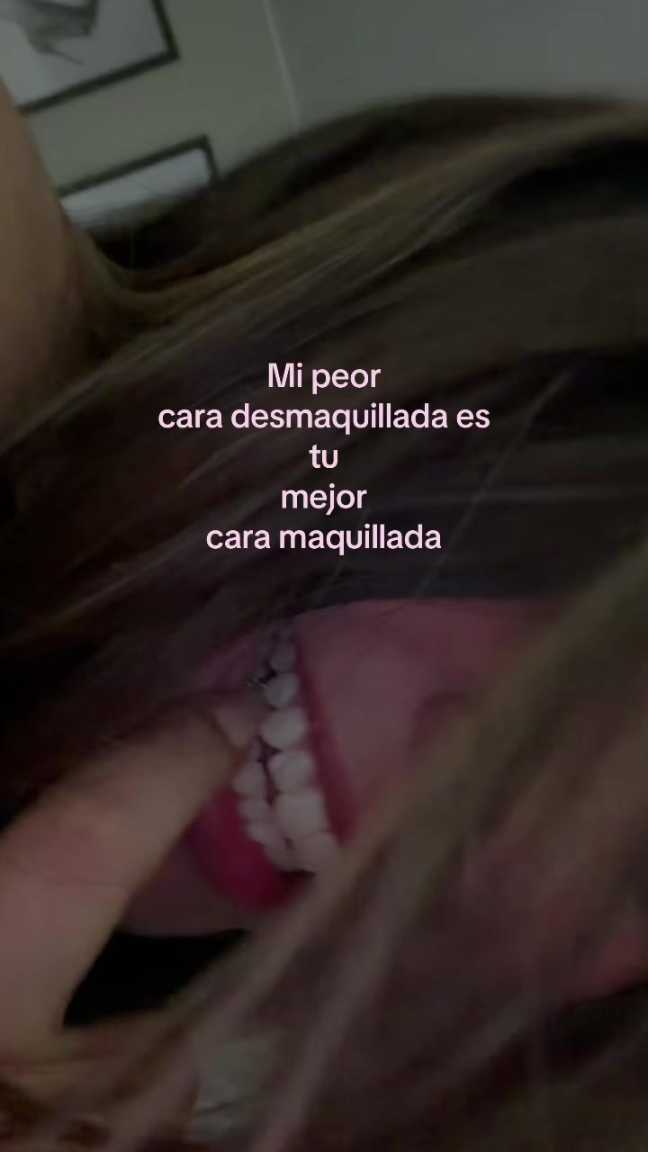 @Lyneth paz