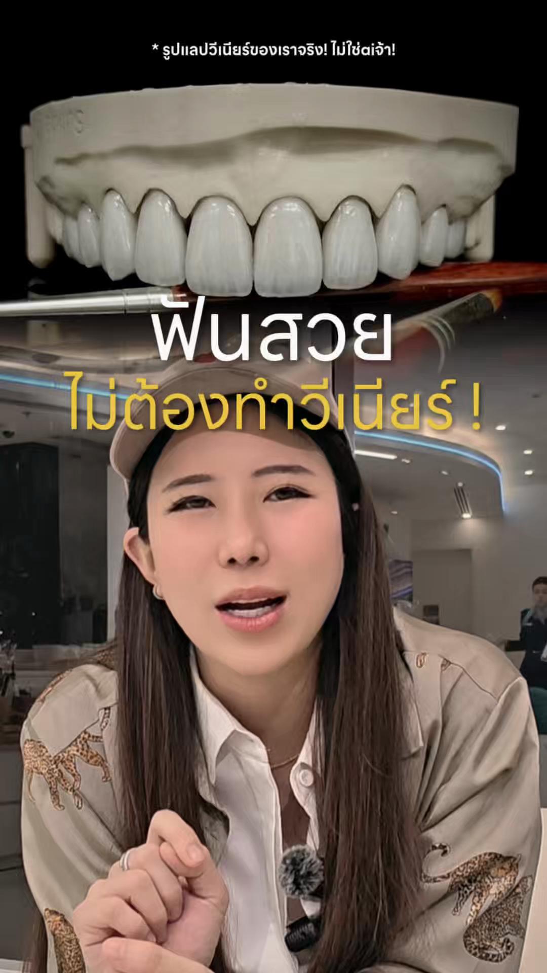 @หมอป่องสวยมาก veneer 🦷