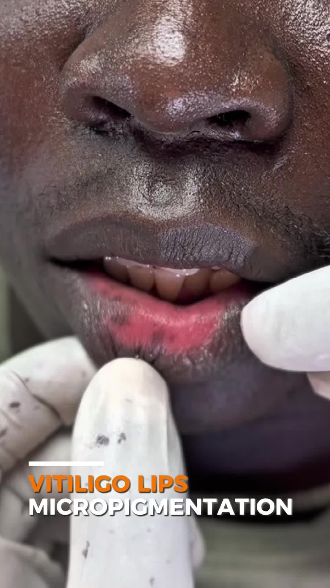 @Skin Dictionary
