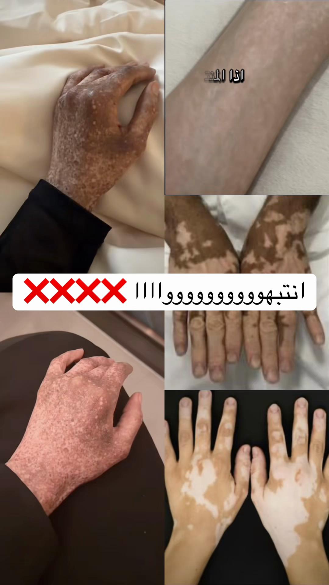 @Amira Beauty