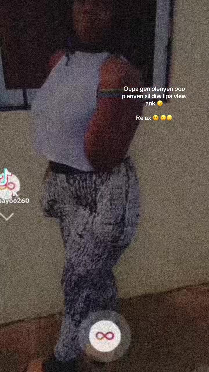 @Bayoo 260