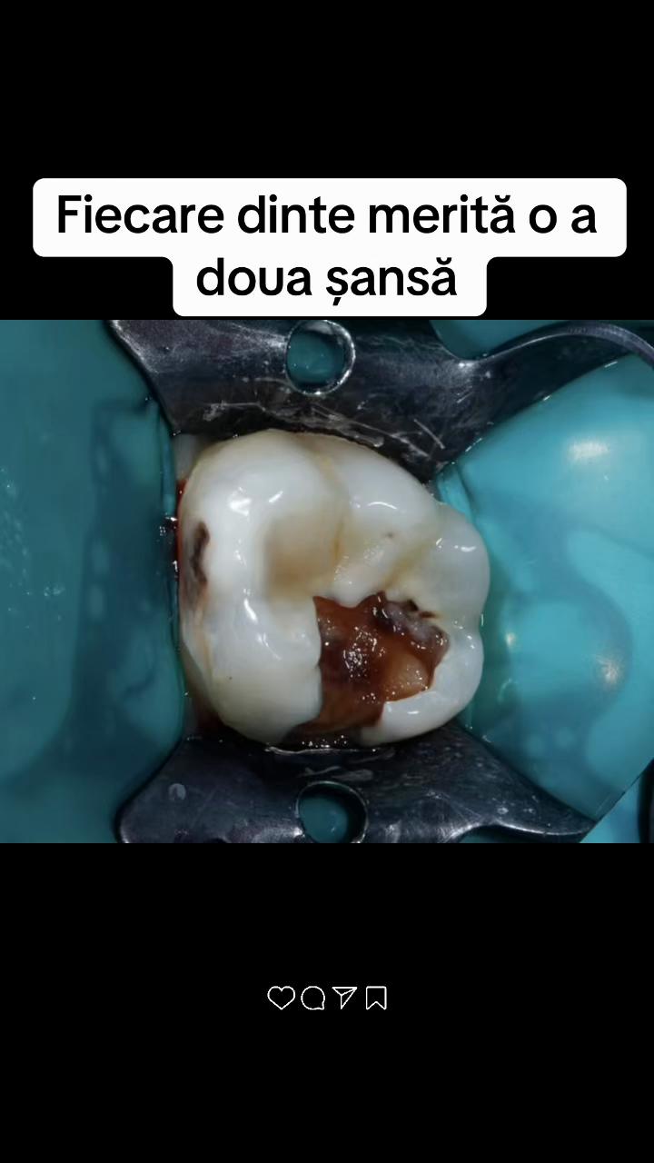@Stomatolog Snejana Carabulea🦷