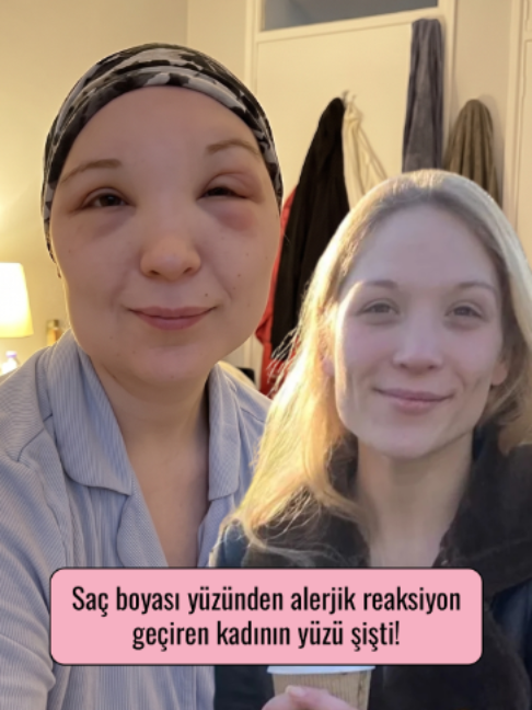 @Mynet Kadin
