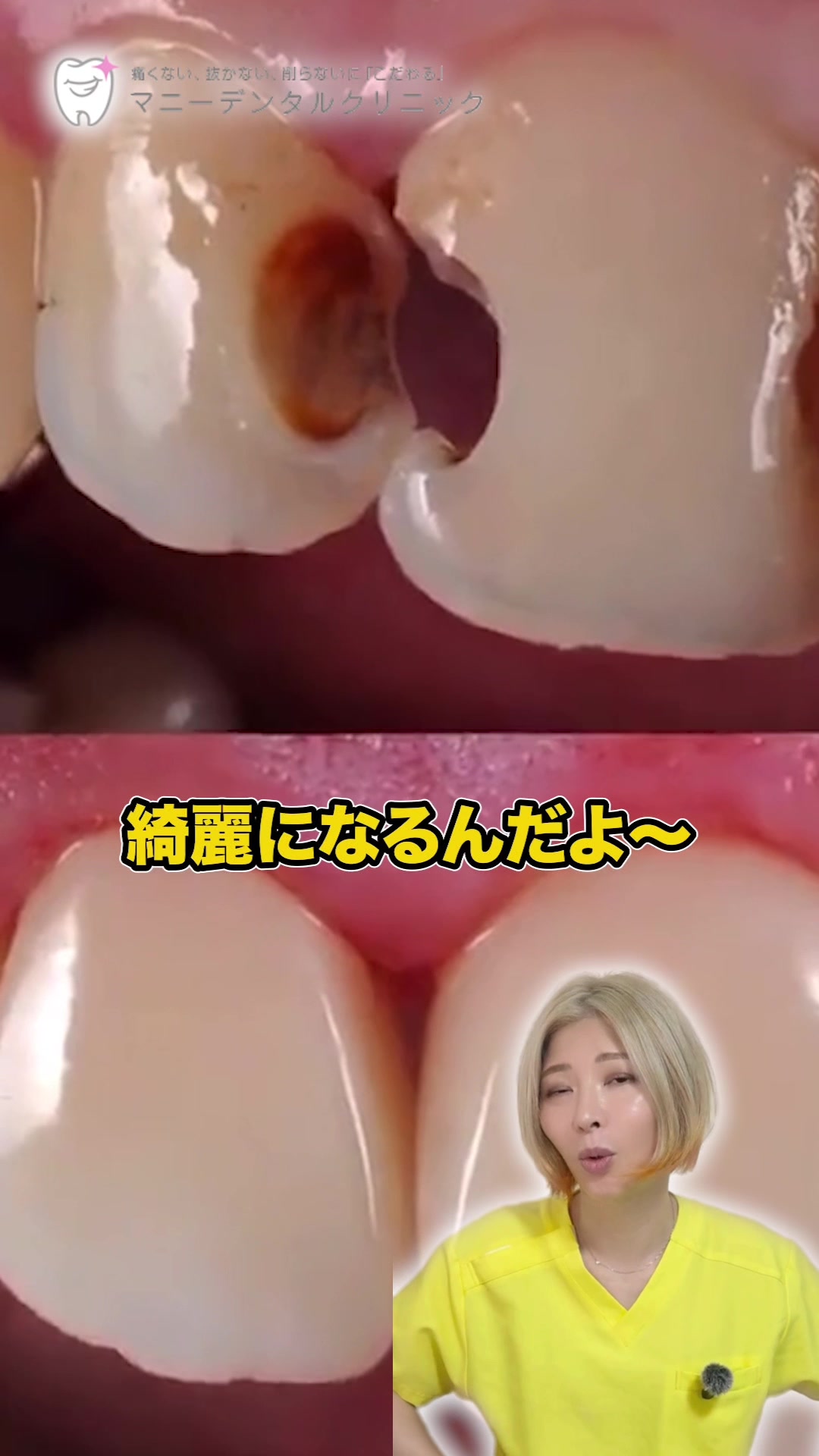 @【歯の無痛治療】マニーデンタルクリニック