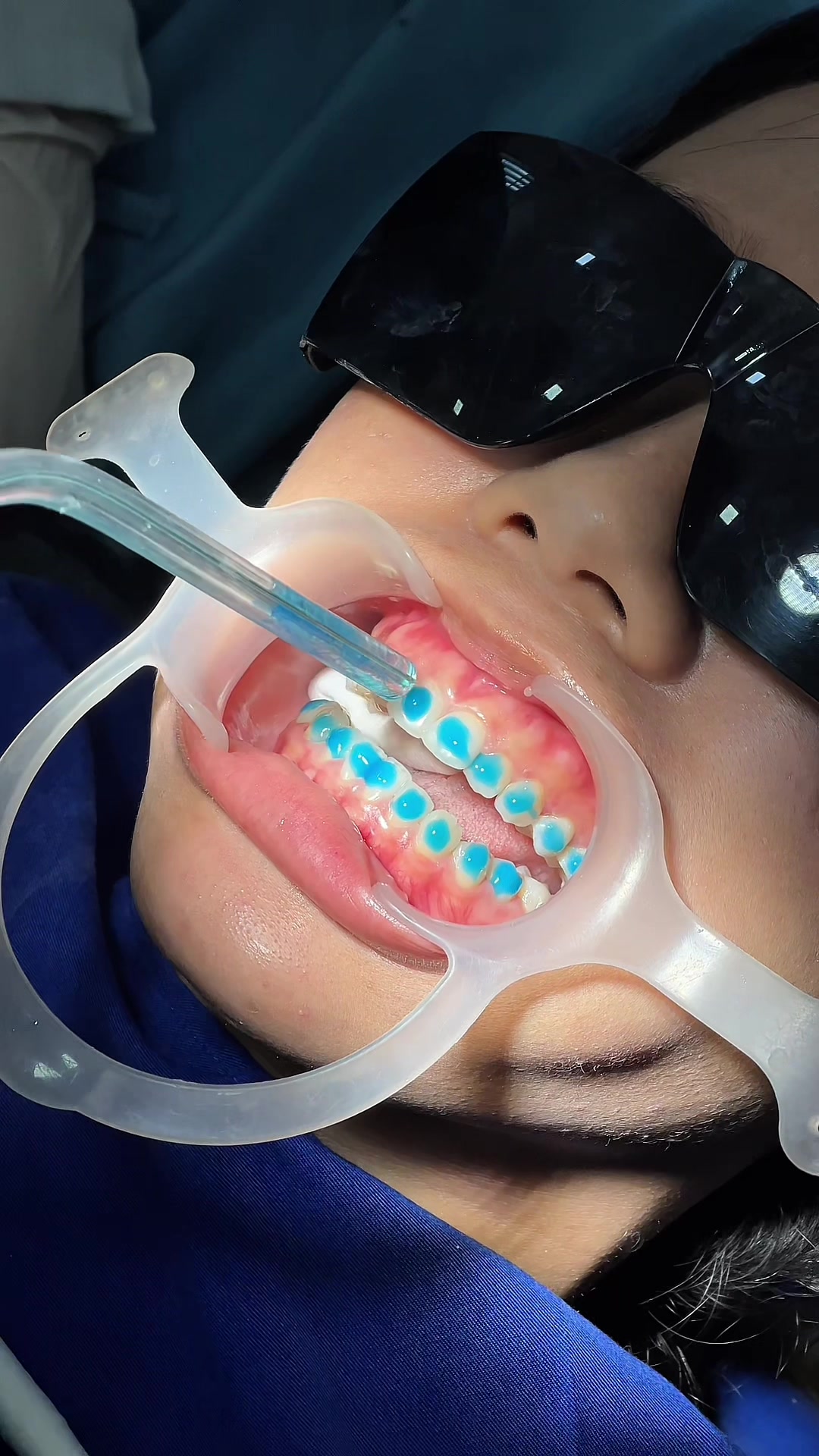 @BRIGHT SMILE DENTAL HOSPITAL