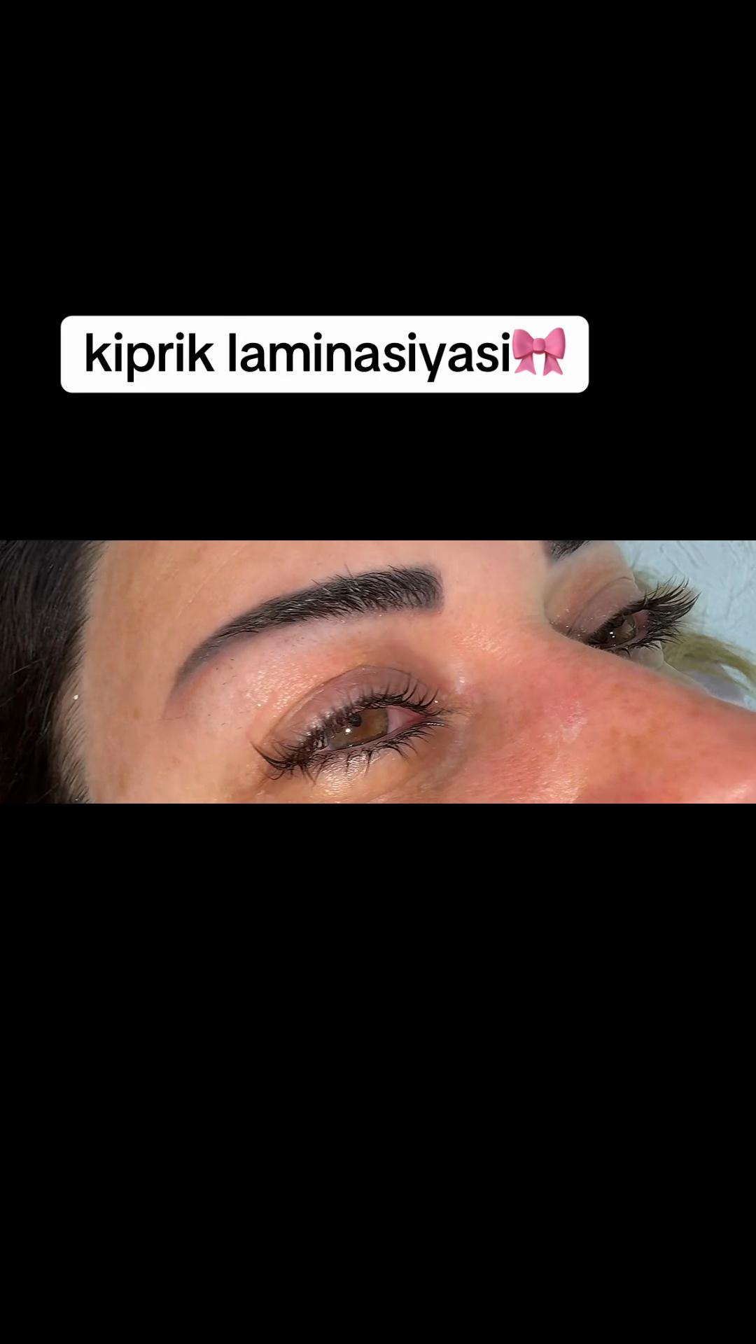 @Bantik_Lazer_epilyasiya_