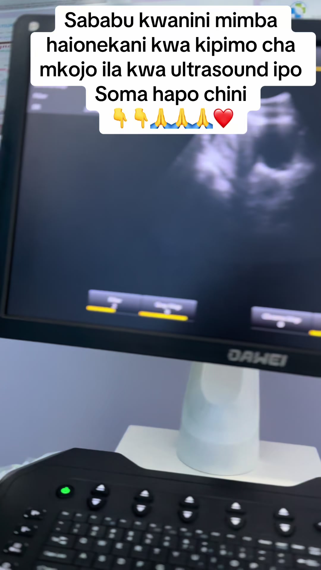 @Doctortiktoktz📞0693676137