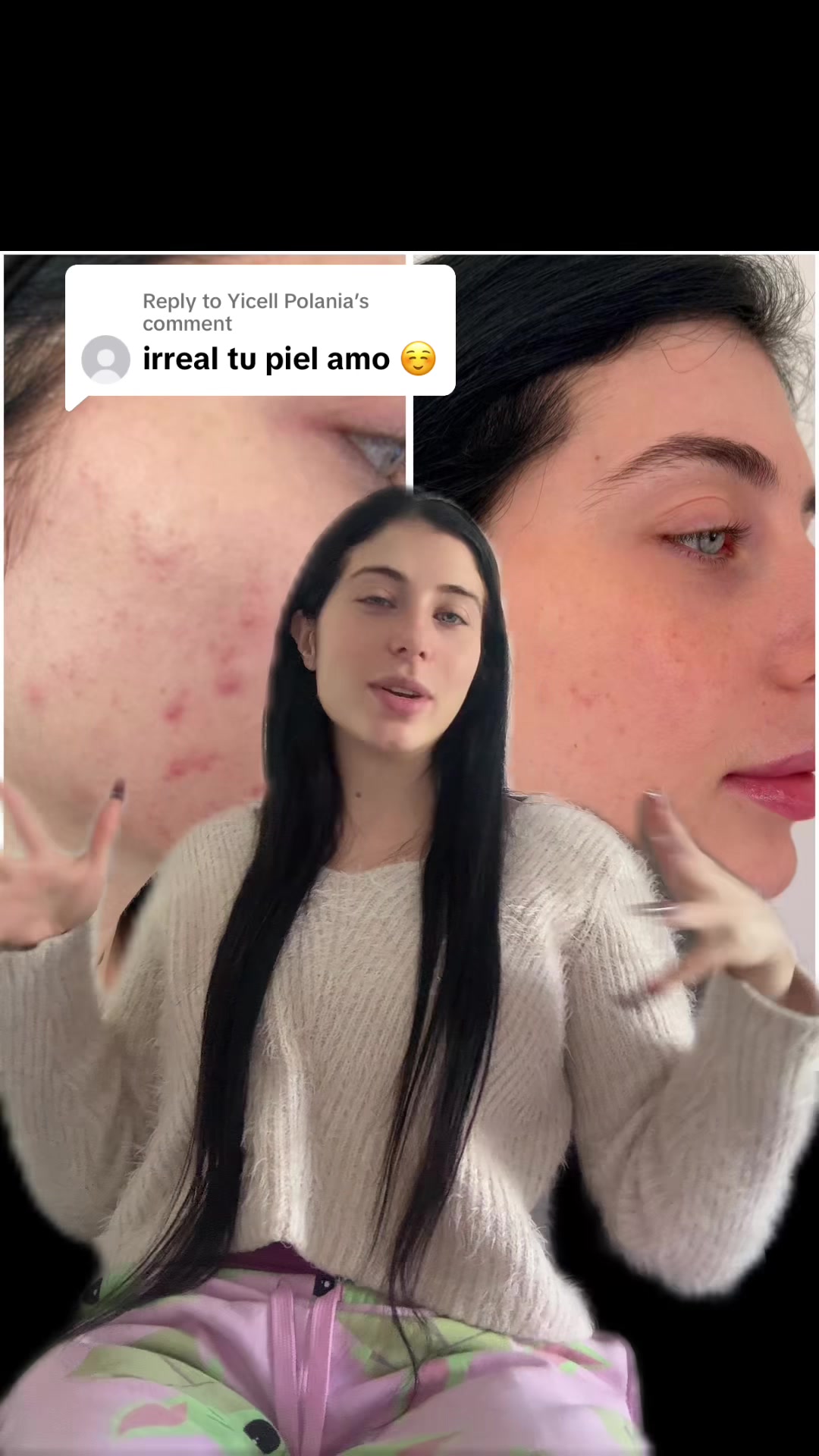 @Nanu