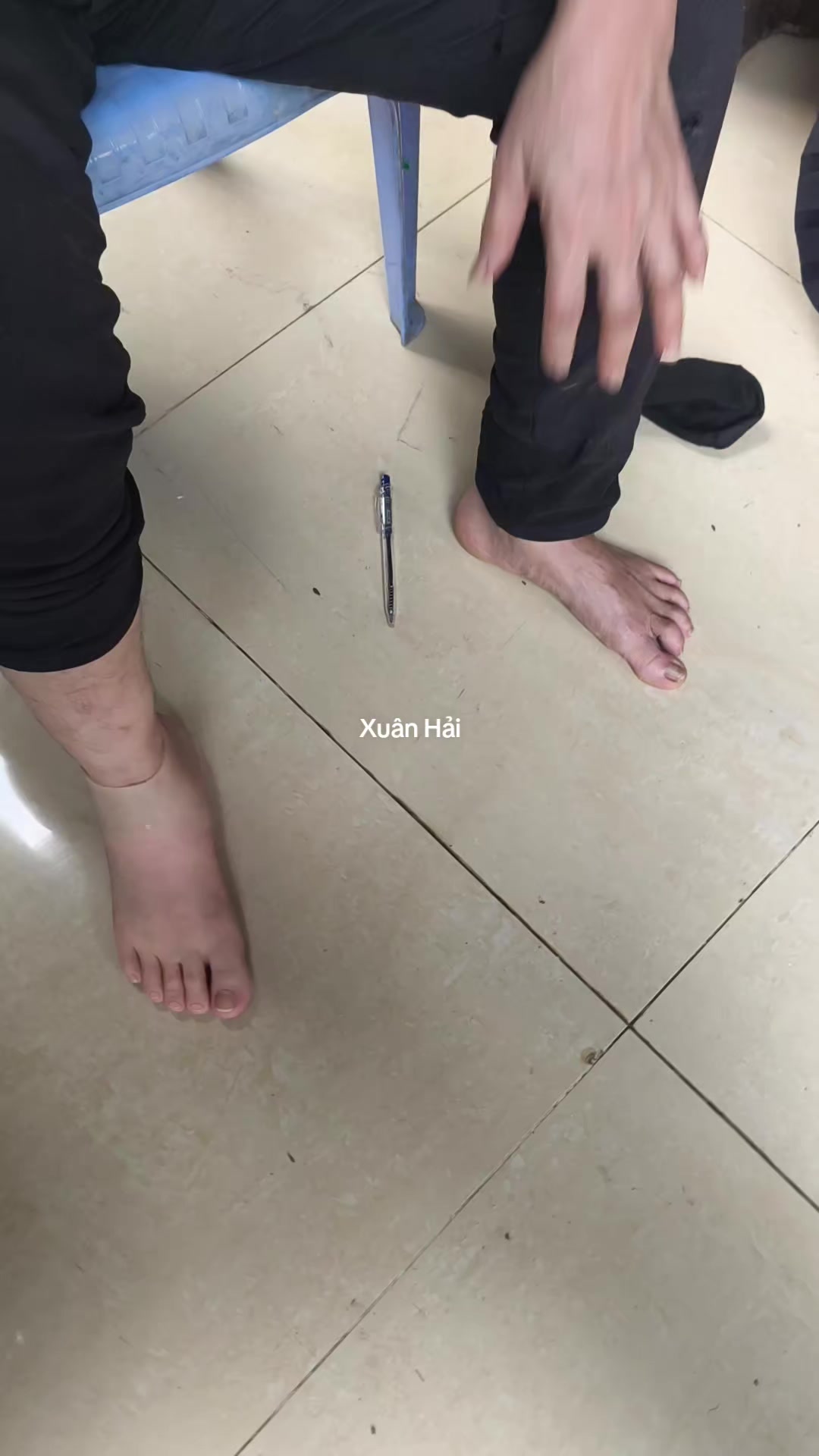 @Hải Râu Tay Chân Giả