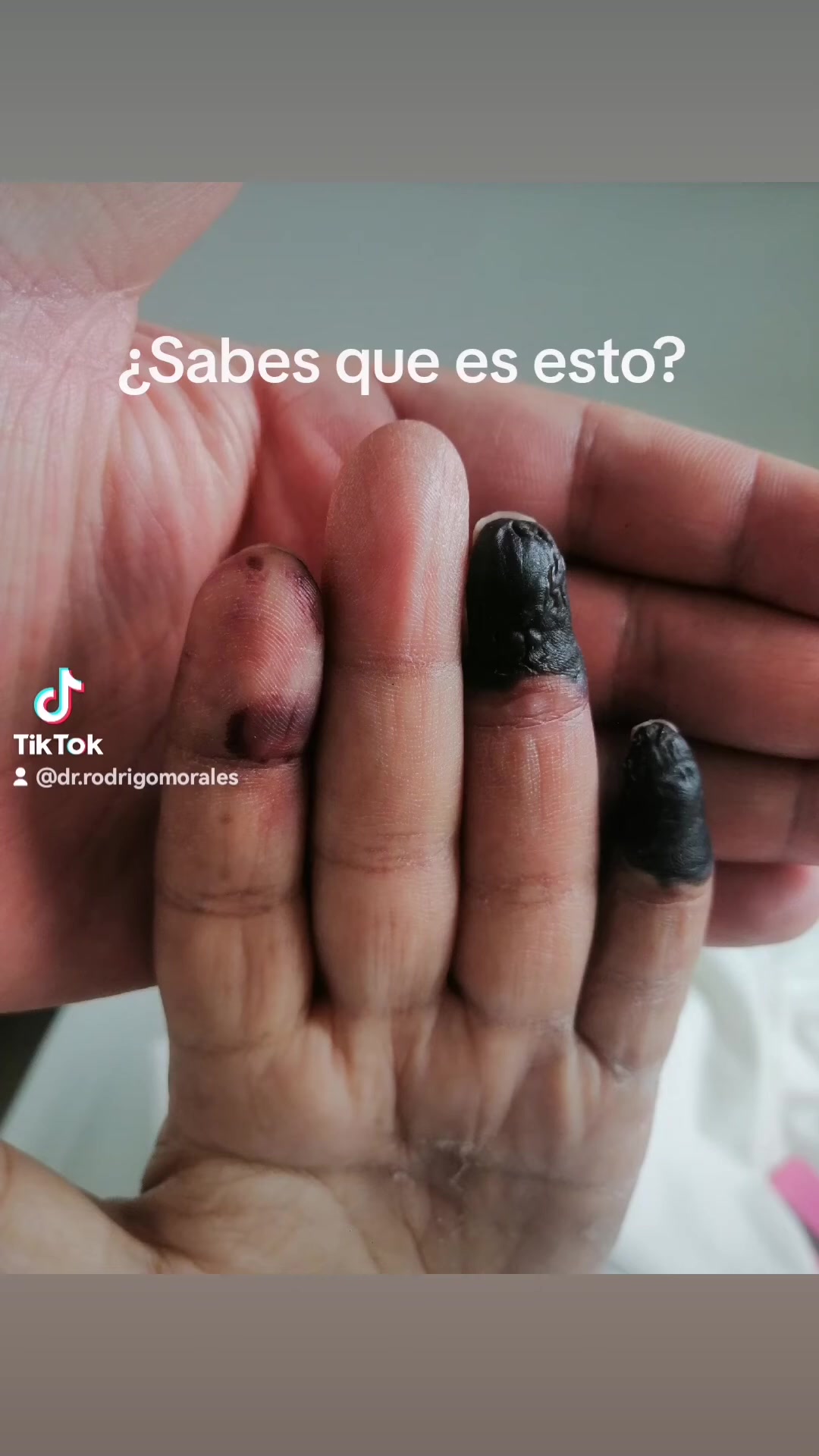 @Dr. Ajolote.