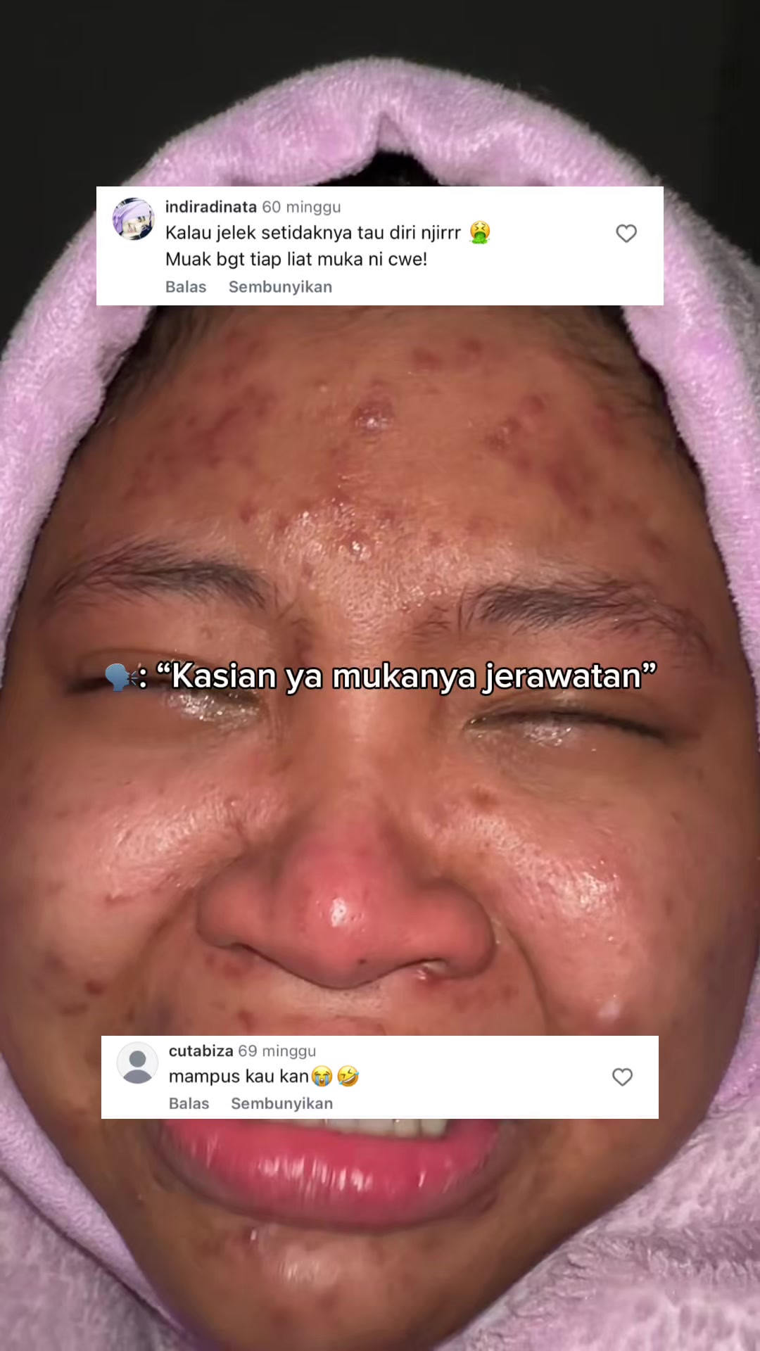 @MBAK CUNGCAT BAYI