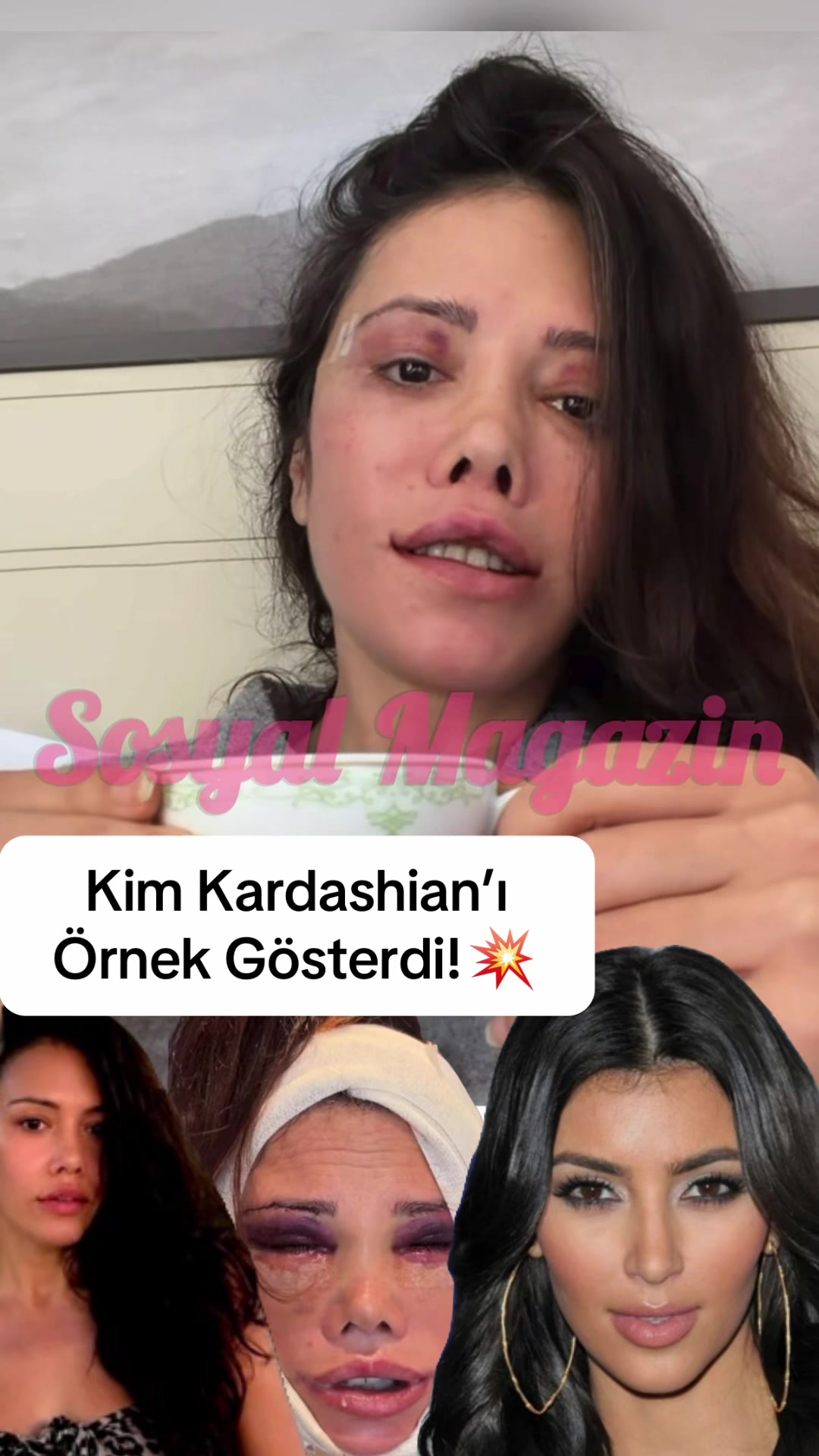 @Sosyaalmagazin