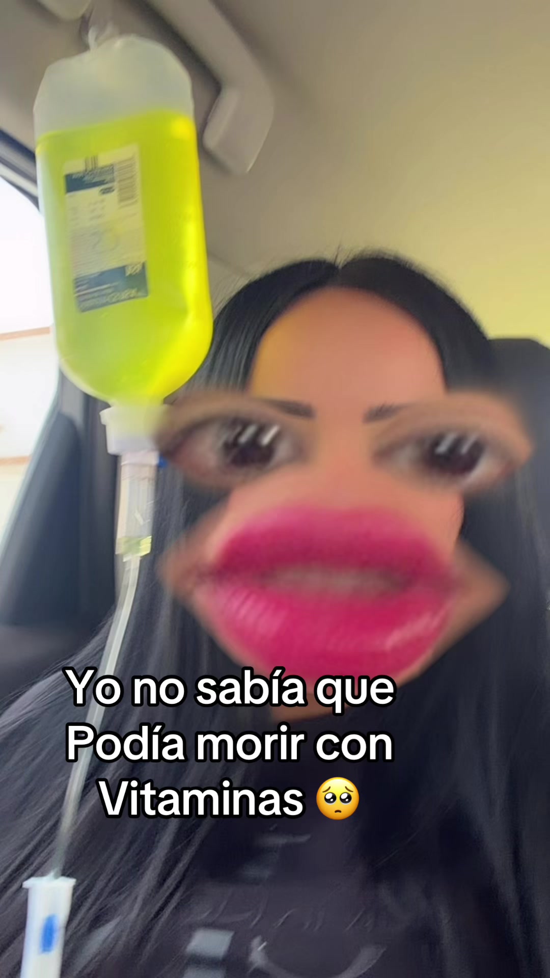 @SinayParedes