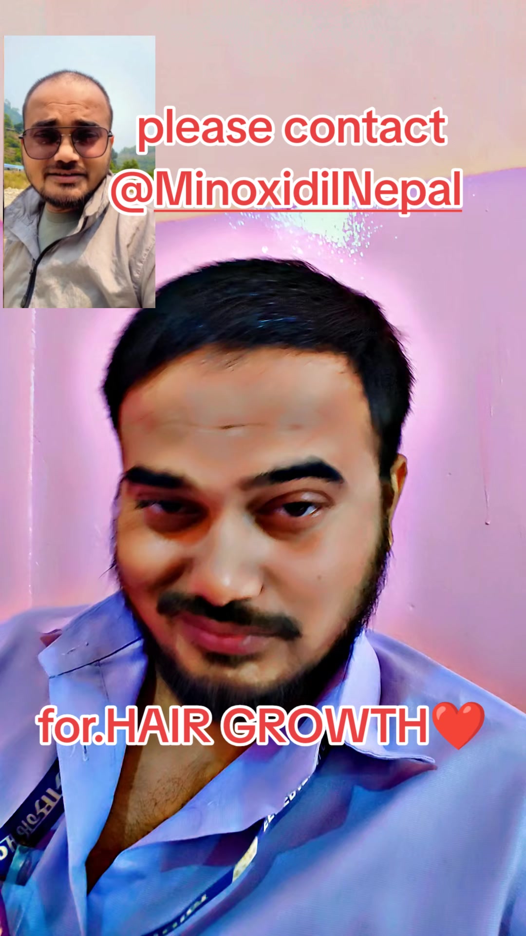 @DipeshSingh. 🕸🕷