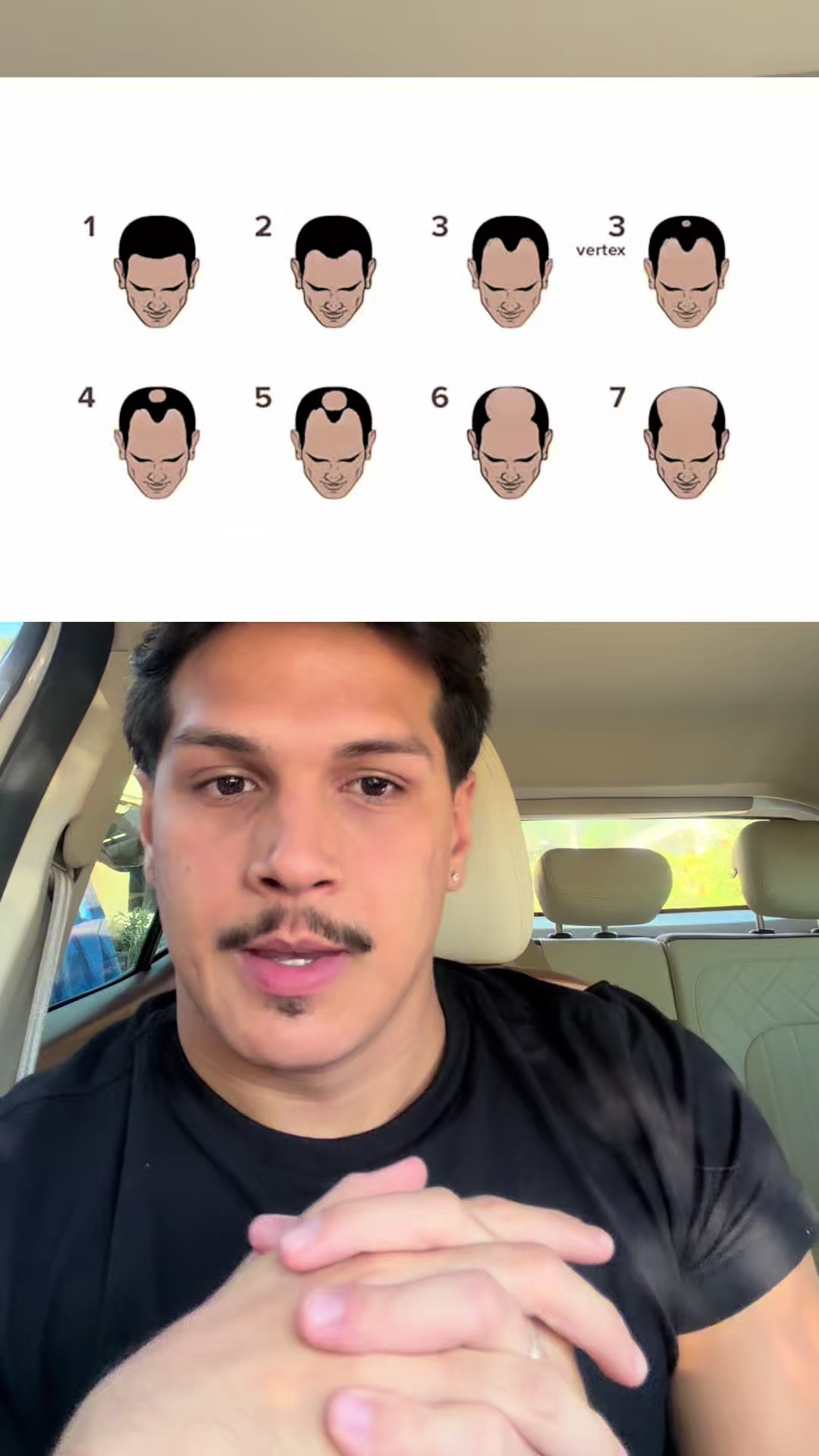 @Rogério Araújo
