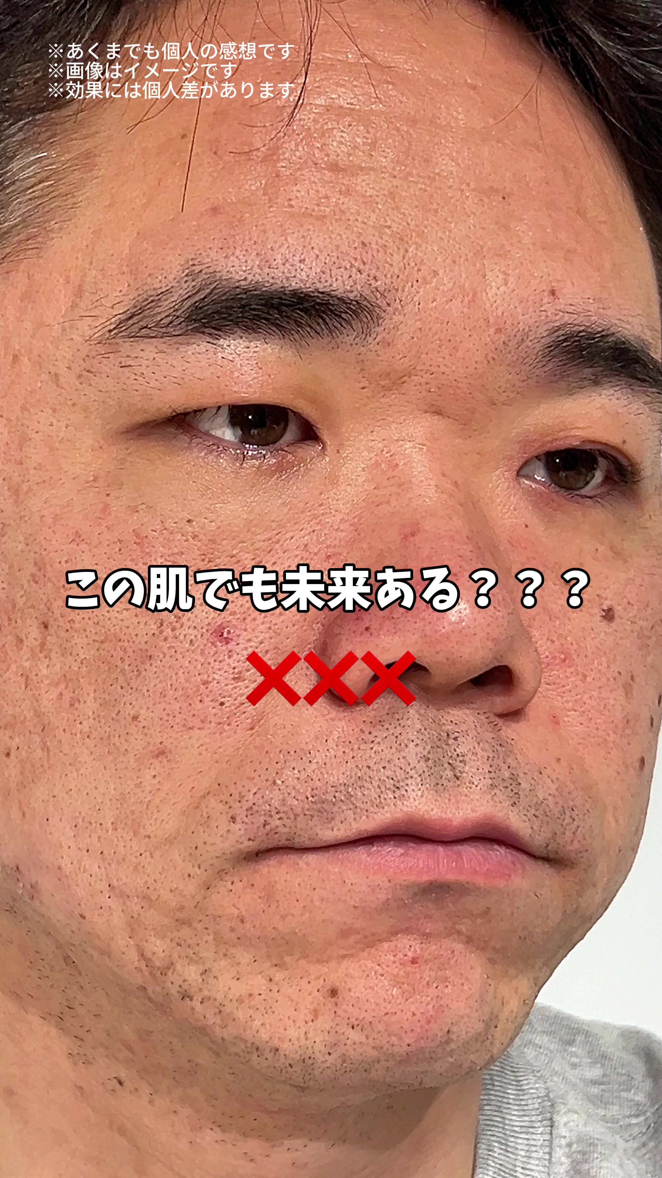 @キルア