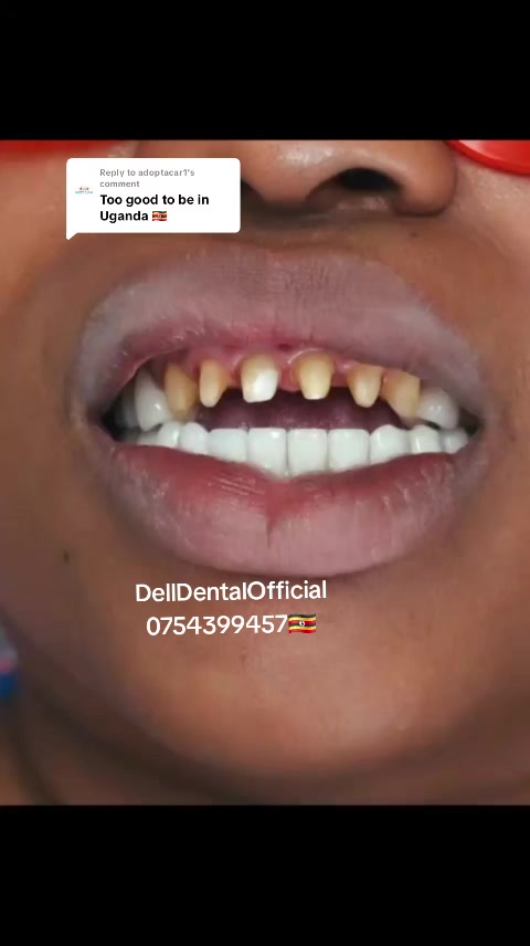 @DellDentalOfficial