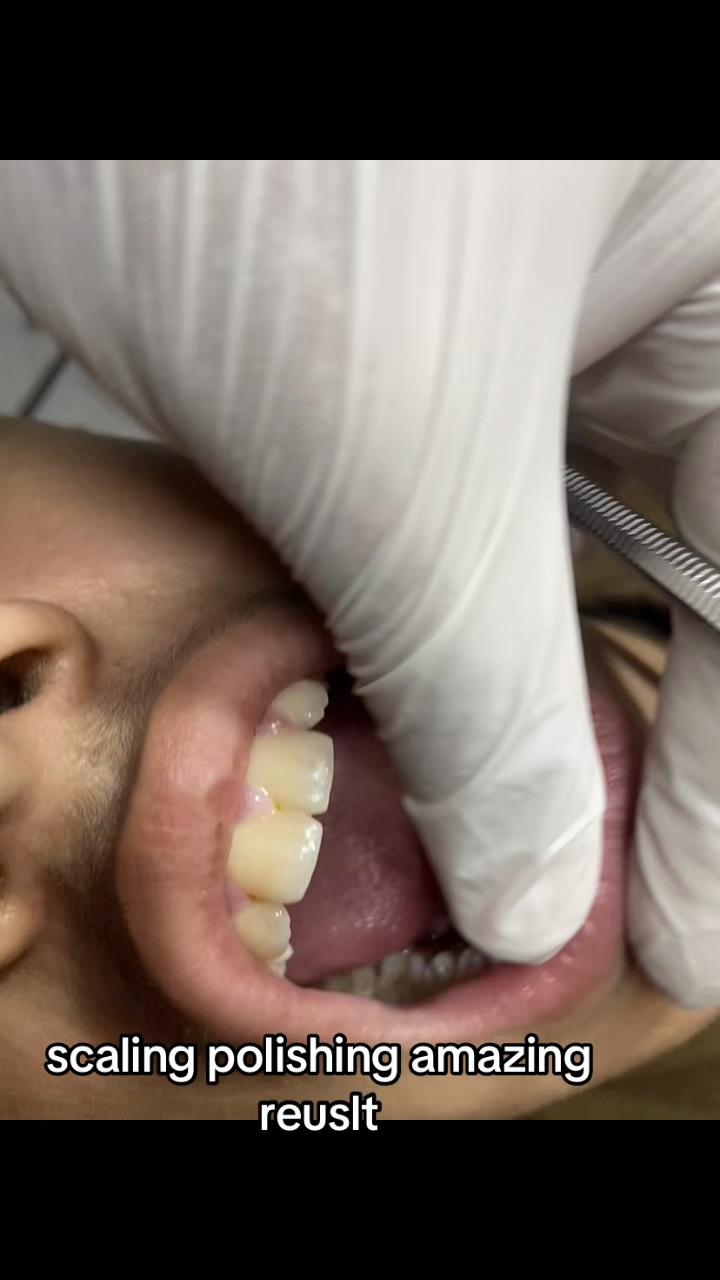 @Aun dental clinic ❤️