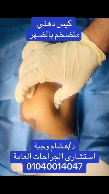 @Dr Hesham Wageh