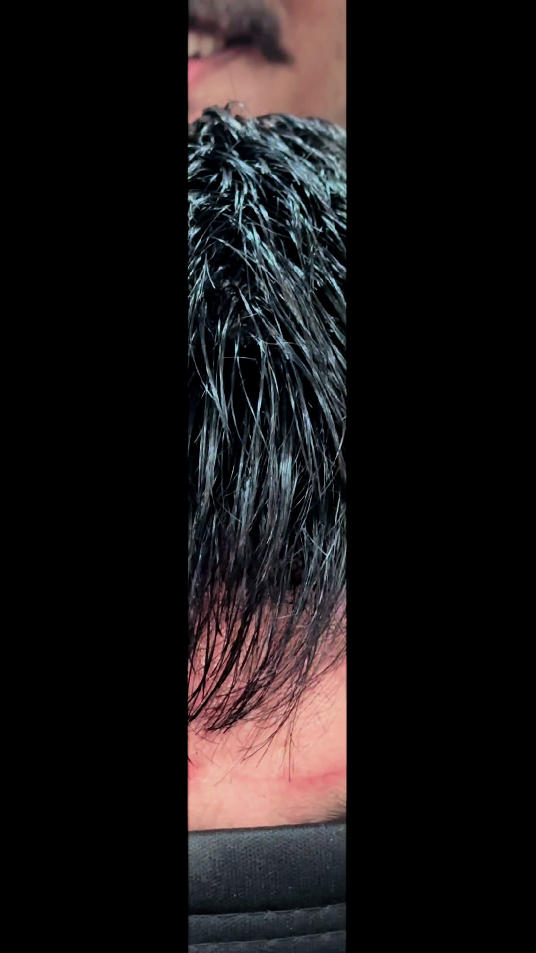 @hairsolutionclub9✅