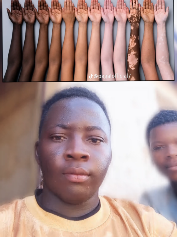 @M&Atilde;D&Icirc;H&Uuml;⚜️SK🥶
