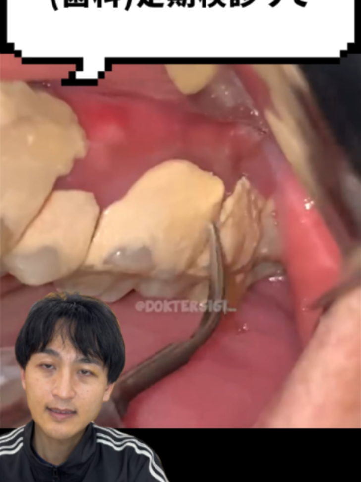 @金歯先生☆歯医者