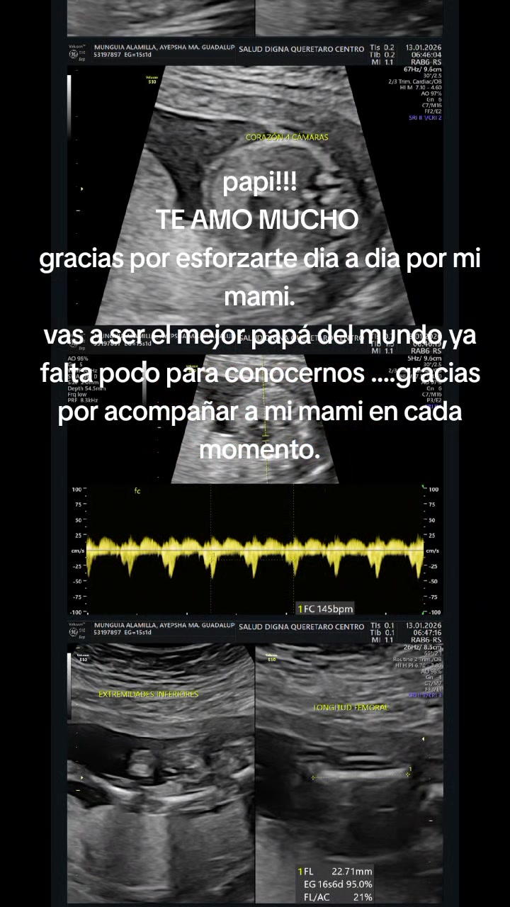 @g&uuml;ero Azul