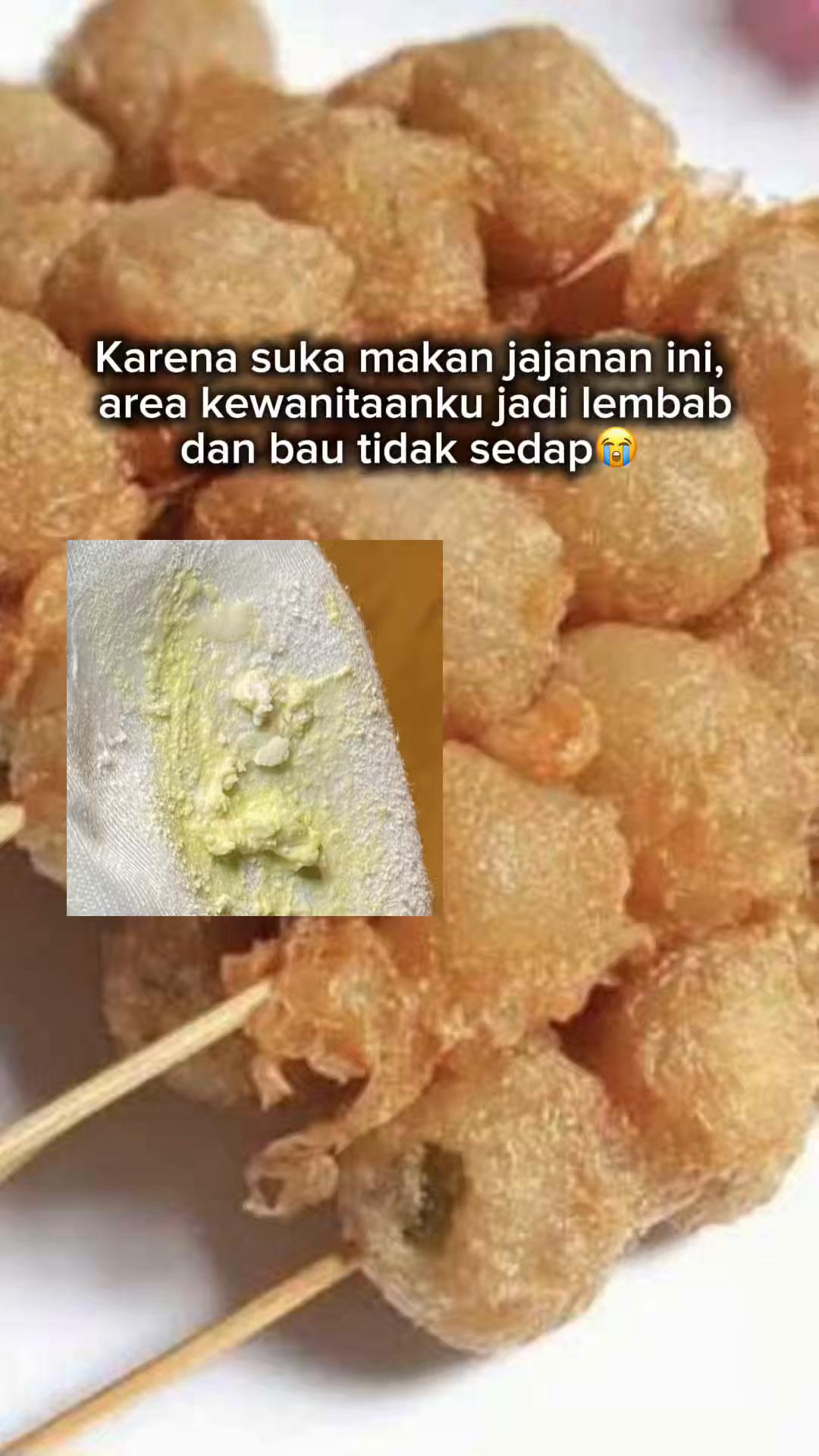 @Hervi Official