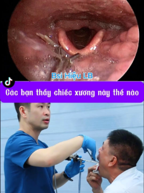 @Bs Hiệu Tai Mũi Họng Long Biên