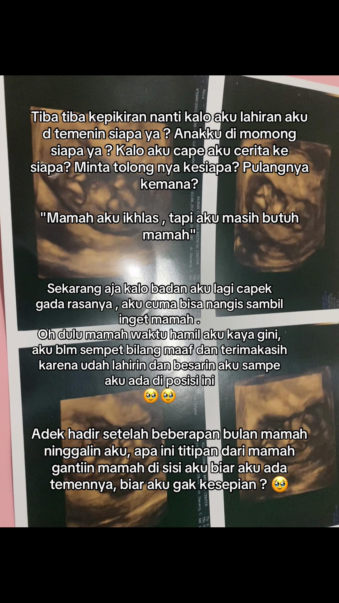 @Nisapeb