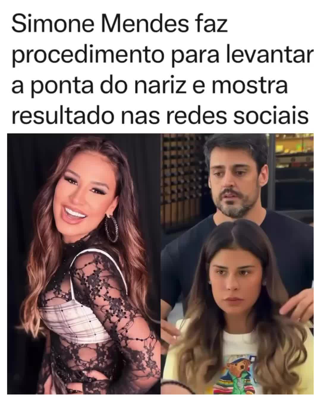 @Alfinetei