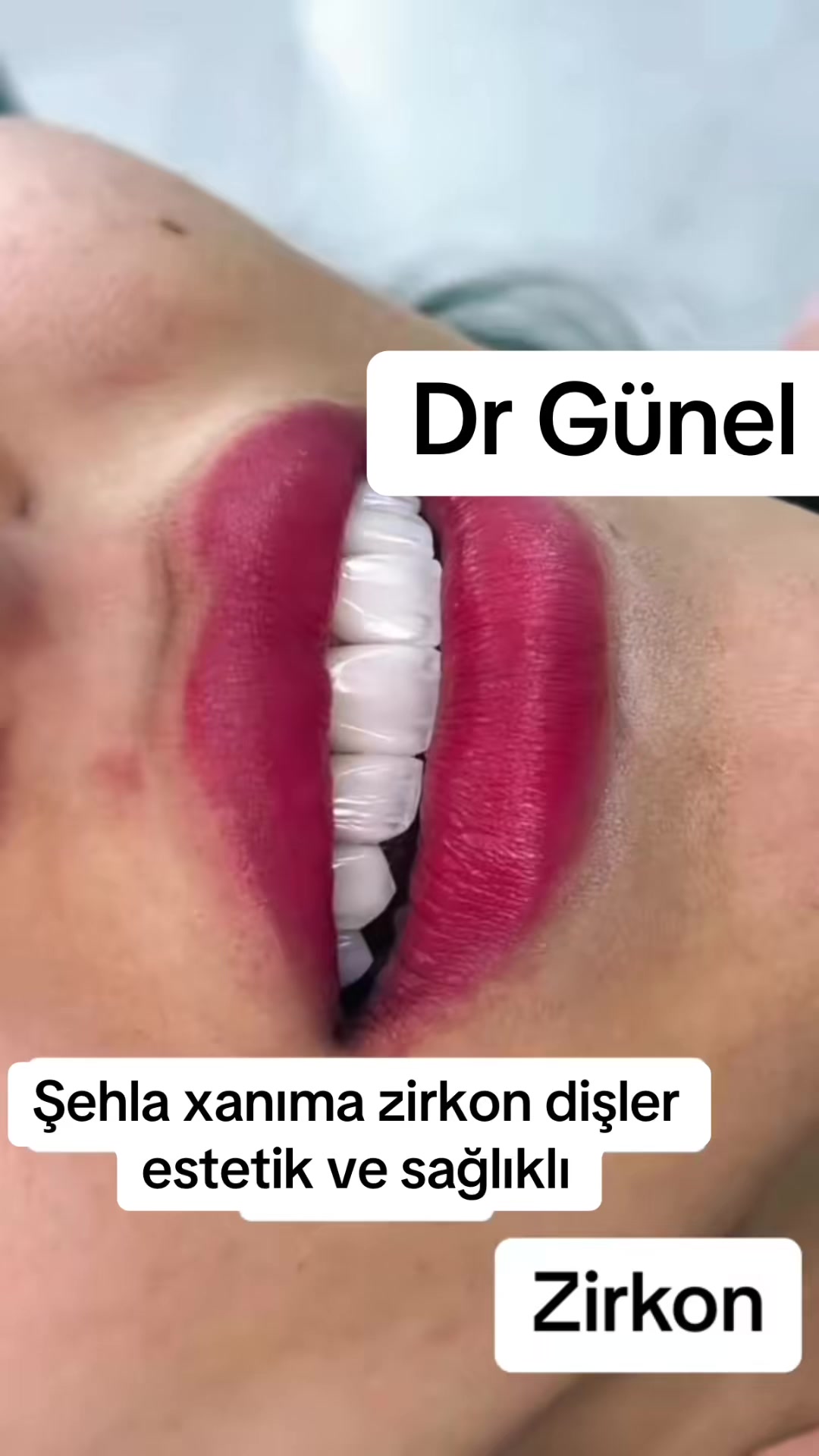 @Dentist_Günel