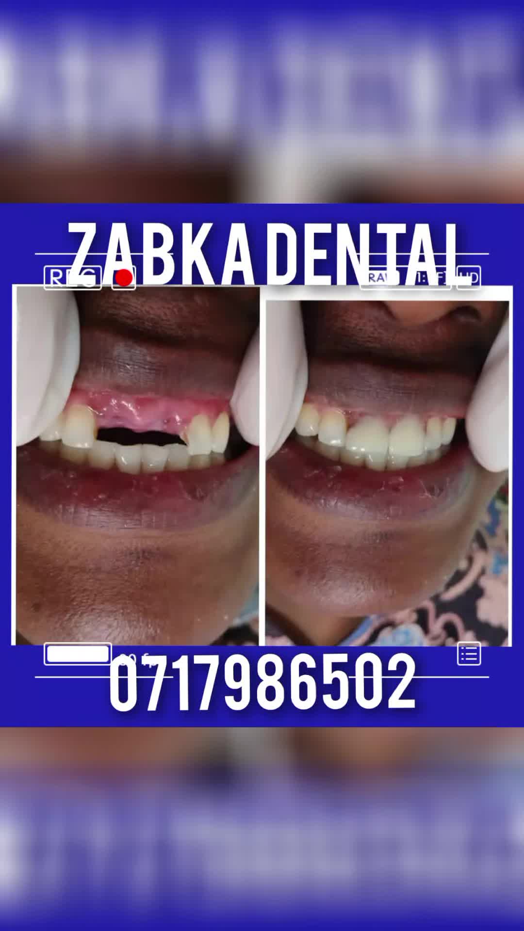 @Zabka Dental
