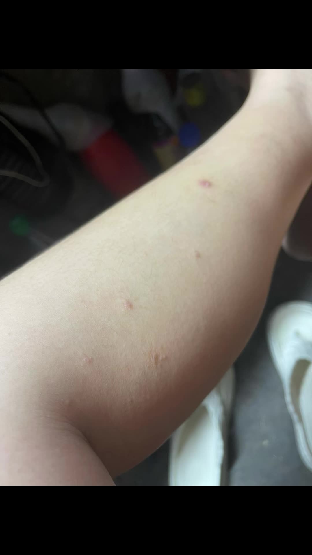@LiezaShopPH