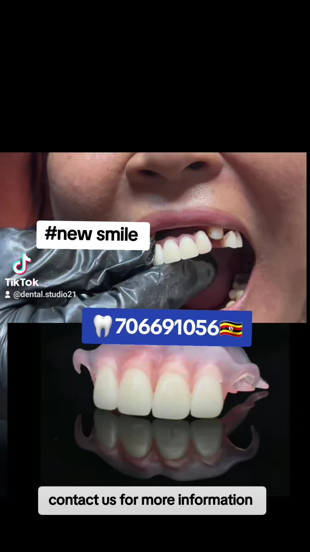 @Dental studio.🦷.Kampala