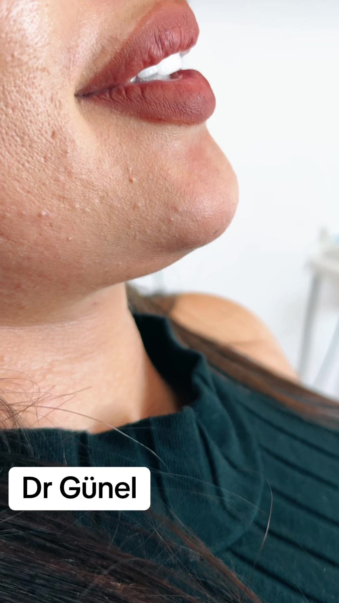 @Dentist_Günel
