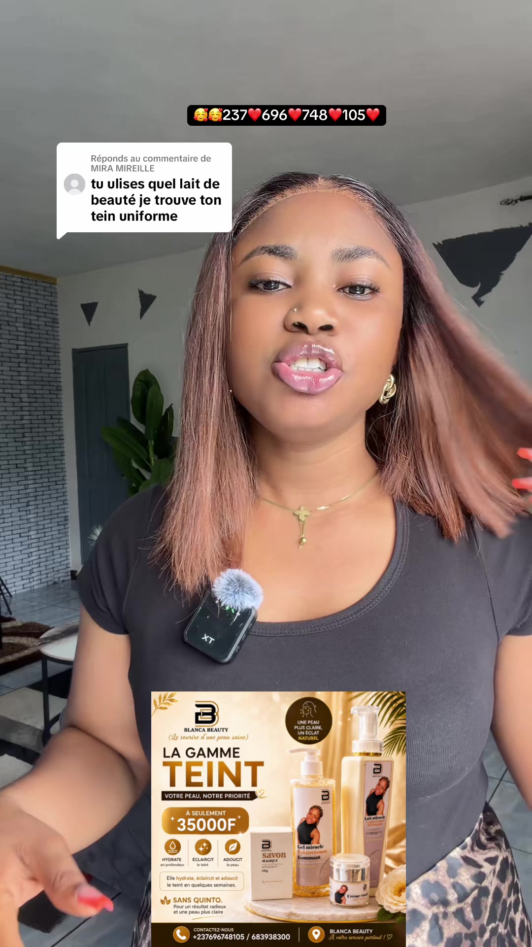@Blanca✨🇨🇲