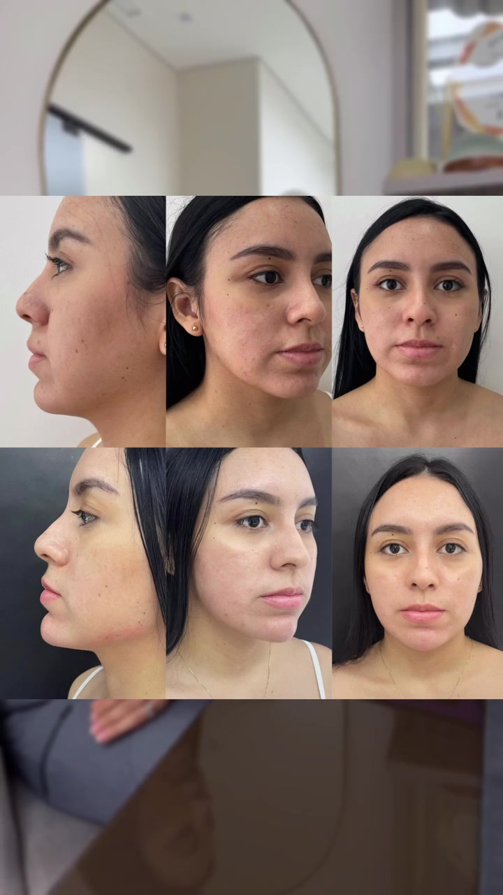 @Eliana Garcés Plastic Surgery