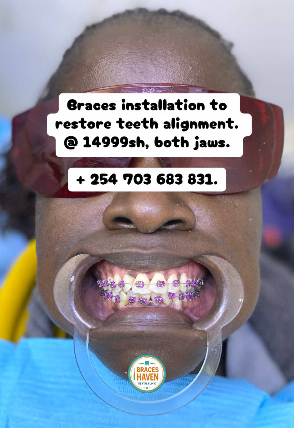 @Braces Haven Nairobi Dental