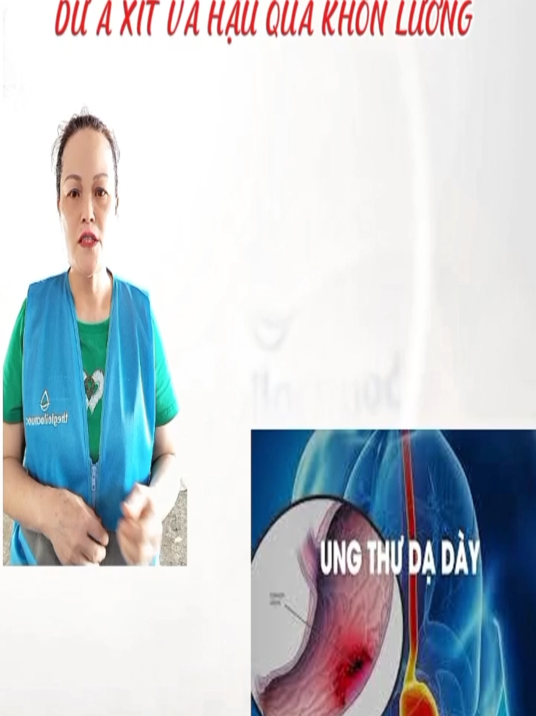 @Duong Dinh