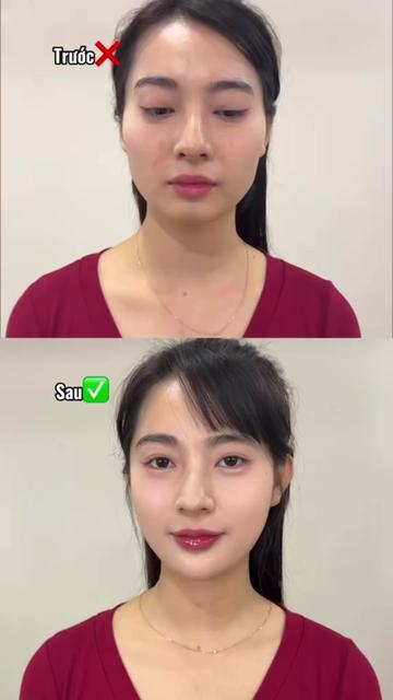 @TN - Filler Botox Đà Nẵng